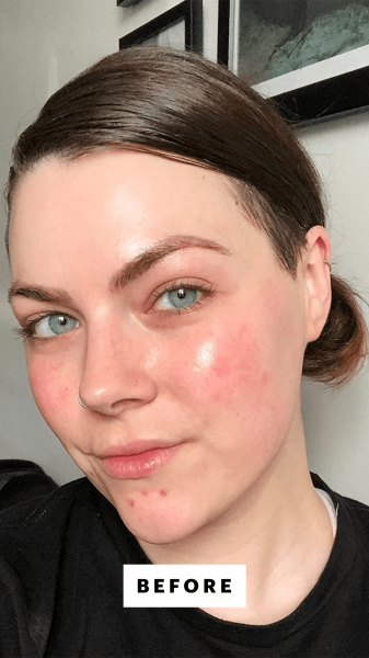 Allure senior news editor Nicola Dall'Asen before applying the Cle Cosmetics CCC Cream